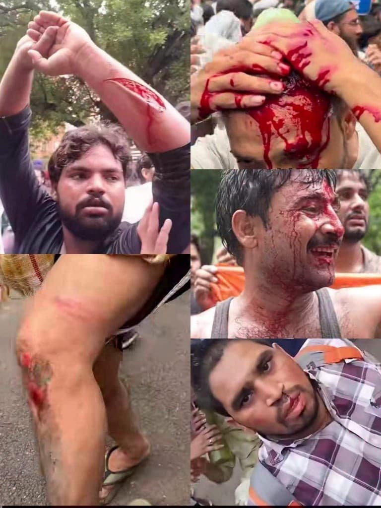 Documented injuries from protesters after police action